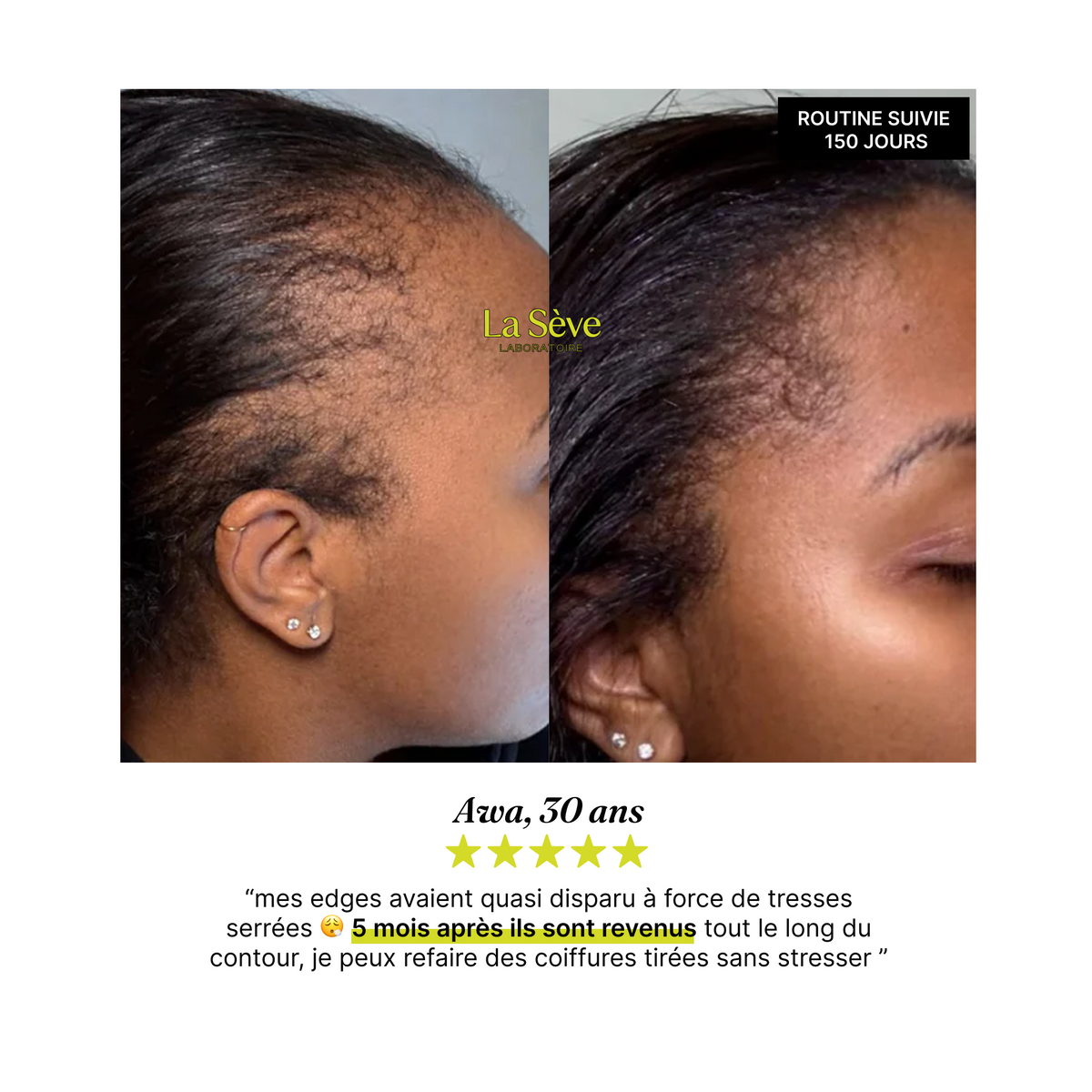 Rituel Complet — Pousse Cheveux